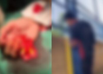 Aluno de escola estadual tem dedo decepado na quadra esportiva