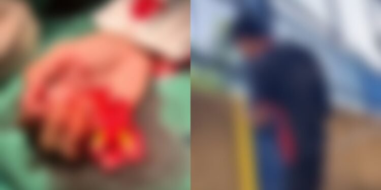 Aluno de escola estadual tem dedo decepado na quadra esportiva