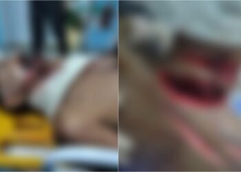 Idoso é atacado a golpes de terçado em Manacapuru no Amazonas