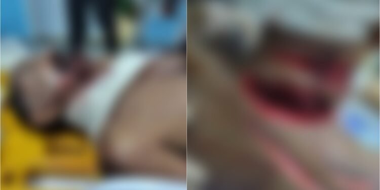 Idoso é atacado a golpes de terçado em Manacapuru no Amazonas