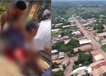 Homem tem as pernas serradas em acidente de trabalho em Autazes