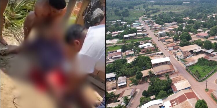 Homem tem as pernas serradas em acidente de trabalho em Autazes