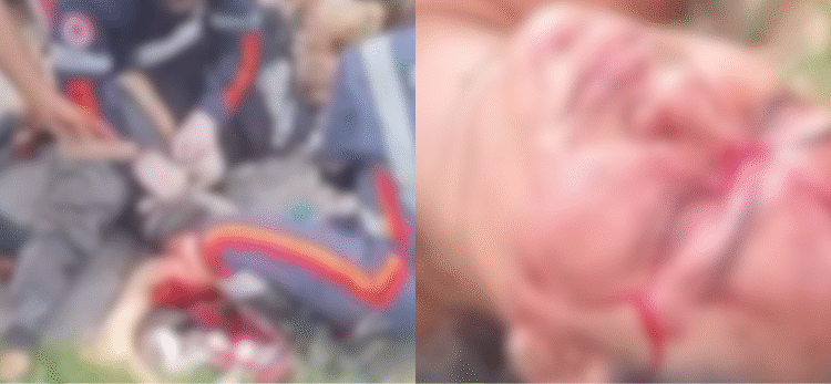 Motociclista de aplicativo e passageira sofrem grave acidente ao baterem em caçamba na zona Norte de Manaus