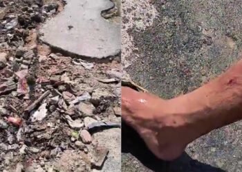 ‘Buraco do David Almeida’ causa acidente e deixa motociclista ferido na zona Leste de Manaus