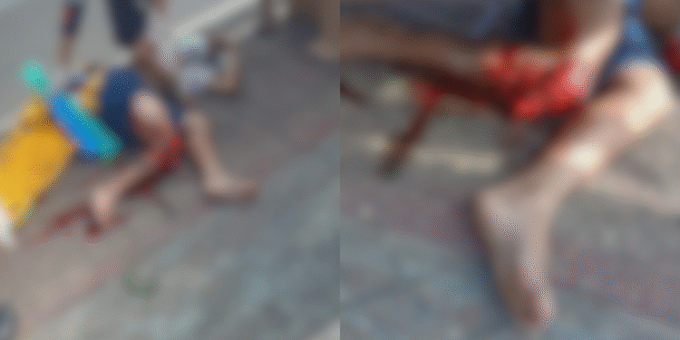 motociclista tem fratura exposta após colidir contra carro na zona Norte de Manaus