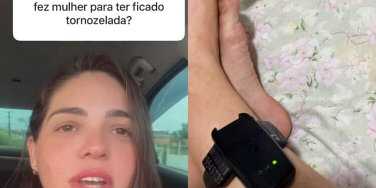 Mulher viraliza ao explicar o motivo de usar tornozeleira eletrônica