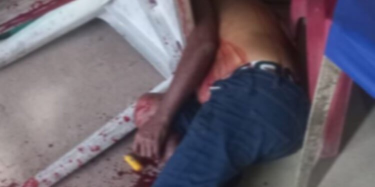 presidente figueiredo - facadas