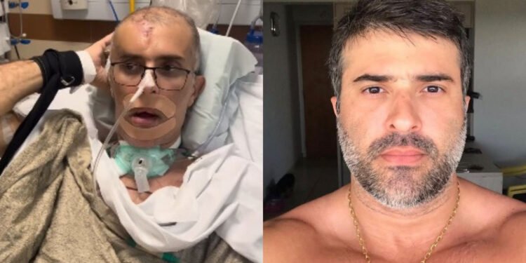 Antes e depois do piloto da Core, Felipe Marques Monteiro (Fotos: Reprodução/Redes Sociais)