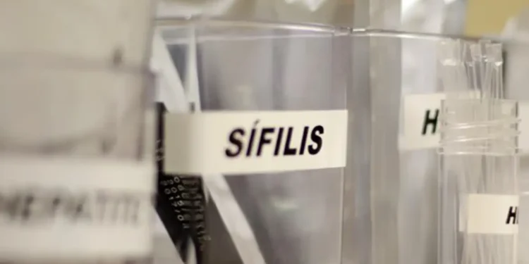 Sífilis continua em ritmo acelerado de crescimento no país