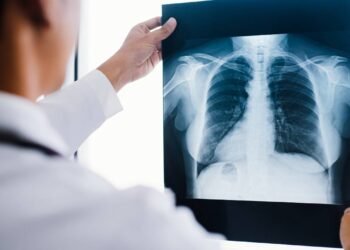 Sindicato dos radiologistas anunciam paralisação dos serviços