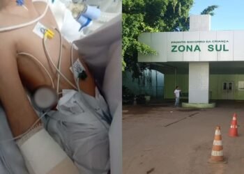 Adolescente tem parte do braço amputado e família denuncia negligência médica no Hospital da Criança zona Sul