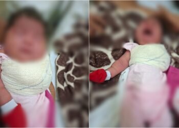 Recém-nascida indígena sofre fraturas e família denuncia violência obstétrica