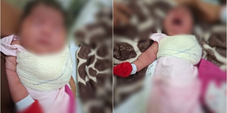 Recém-nascida indígena sofre fraturas e família denuncia violência obstétrica