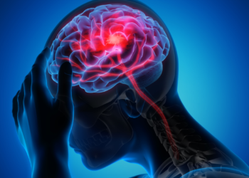 AVC: doença matou um brasileiro a cada 6 minutos em 2025