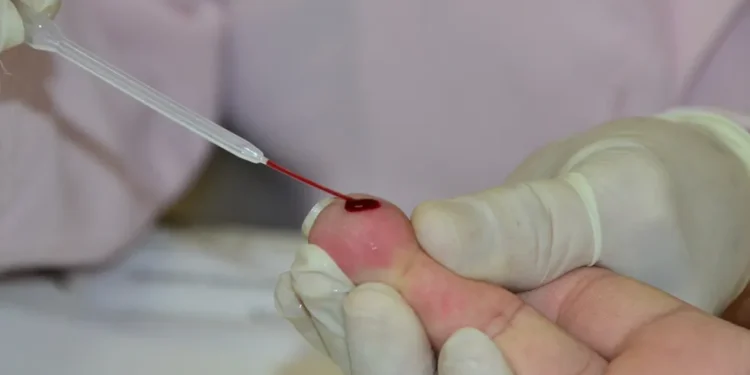 sifilis_teste_rapido