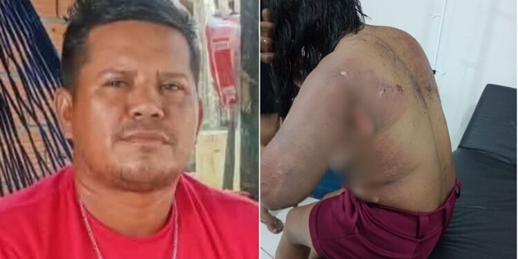 Domiciliano Soares é procurado após atear fogo na ex-companheira