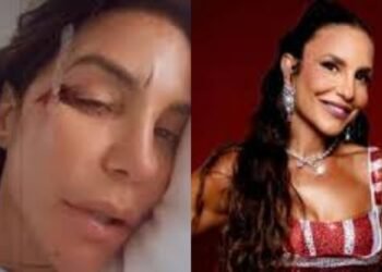 Ivete Sangalo desmaia após desidratação e tranquiliza fãs
