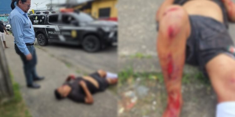 Homem esfaqueado pede ajuda em frente a delegacia na zona Leste de Manaus