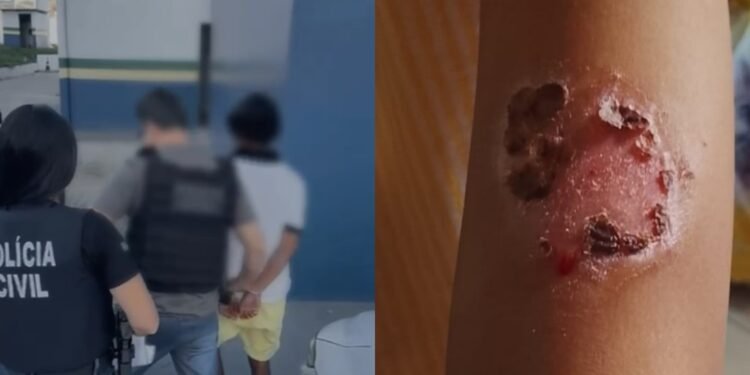 Homem é preso suspeito de torturar os próprios filhos com utensílios aquecidos em Manaus