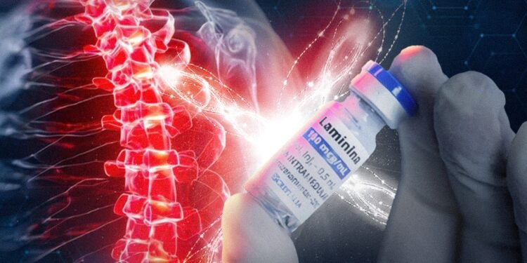 polilaminina-paralisia