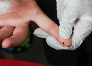 Teste rápido de dengue passa a integrar tabela do SUS