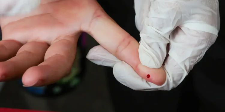 Teste rápido de dengue passa a integrar tabela do SUS