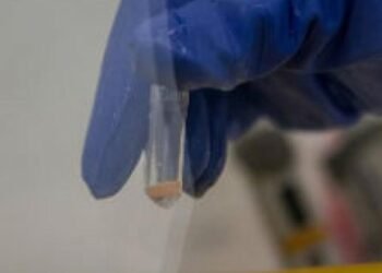 Vacina contra cepa do ebola na África pode demorar até 9 meses