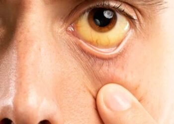 Amazonas registra queda de 69% nos casos de hepatites virais