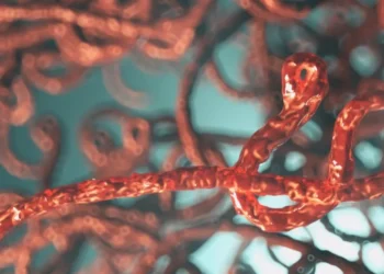 ebola