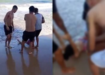 Jovem tem perna amputada após ataque de tubarão em praia de Pernambuco