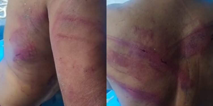 pescador agredido