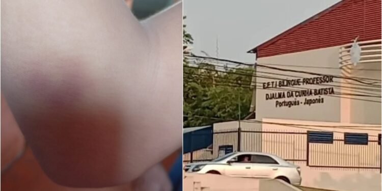 Mãe denuncia agressões e bullying contra filho dentro de escola estadual em Manaus