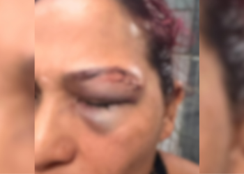 lutadora é agredida