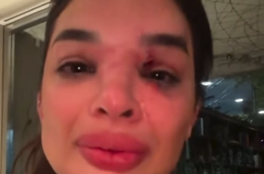 Vítima contou o caso nas redes sociais (Foto: Reprodução/Redes Sociais)